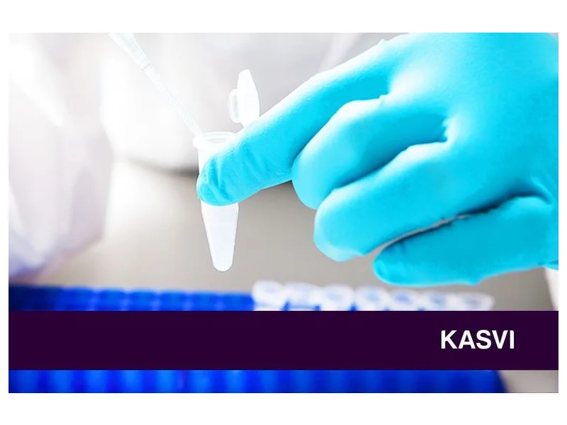 Microtubo 0,2 mL para PCR — Kasvi